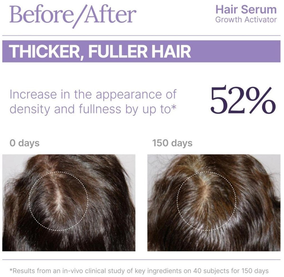 Keranique Hair Serum Growth Activator