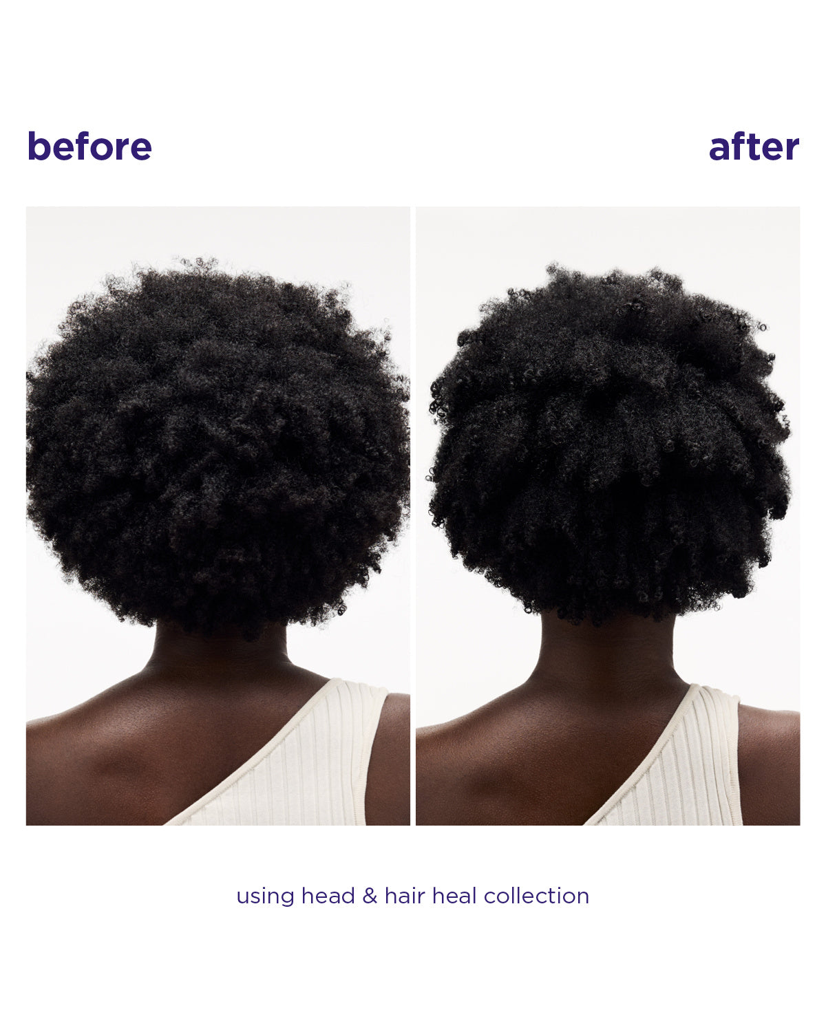 Head & Hair Heal voor en na resultaat