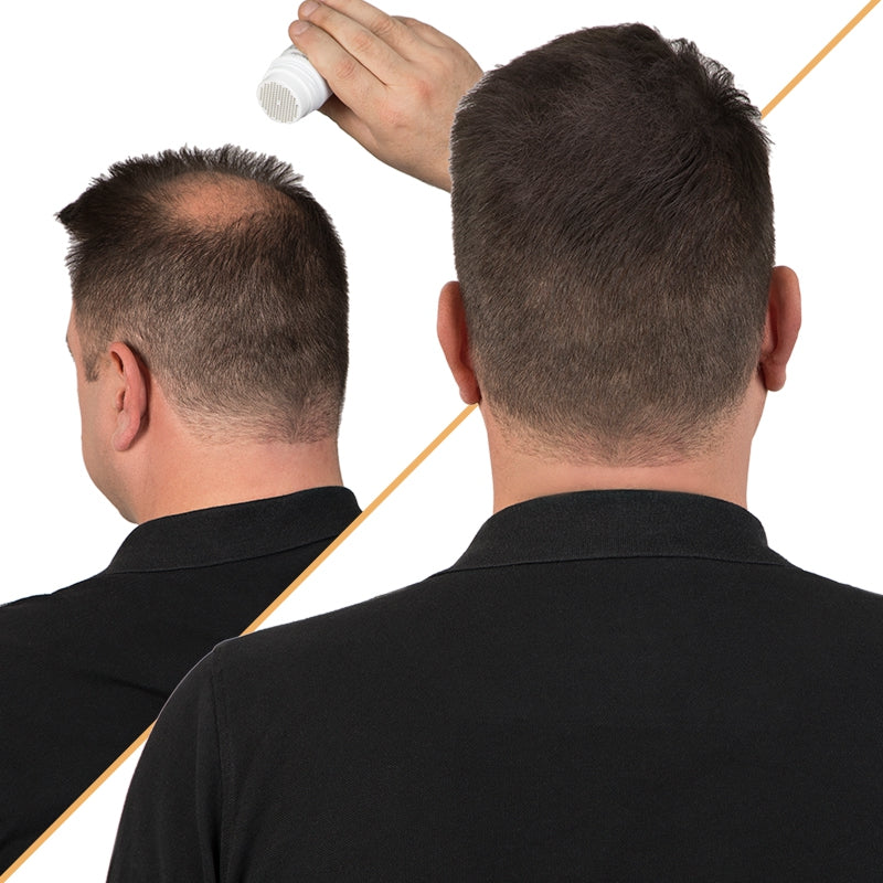 Kapilab Hair Fibers - 5 gram