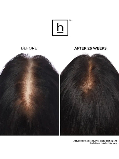 Hairmax Laserband 82 