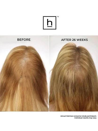 Hairmax Laserband 82 