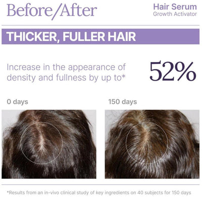 Keranique Hair Serum Growth Activator