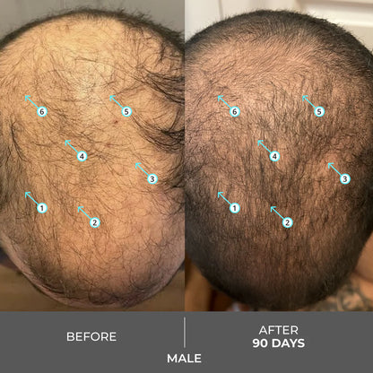 DS Laboratories Revita Shampoo gegen Haarausfall