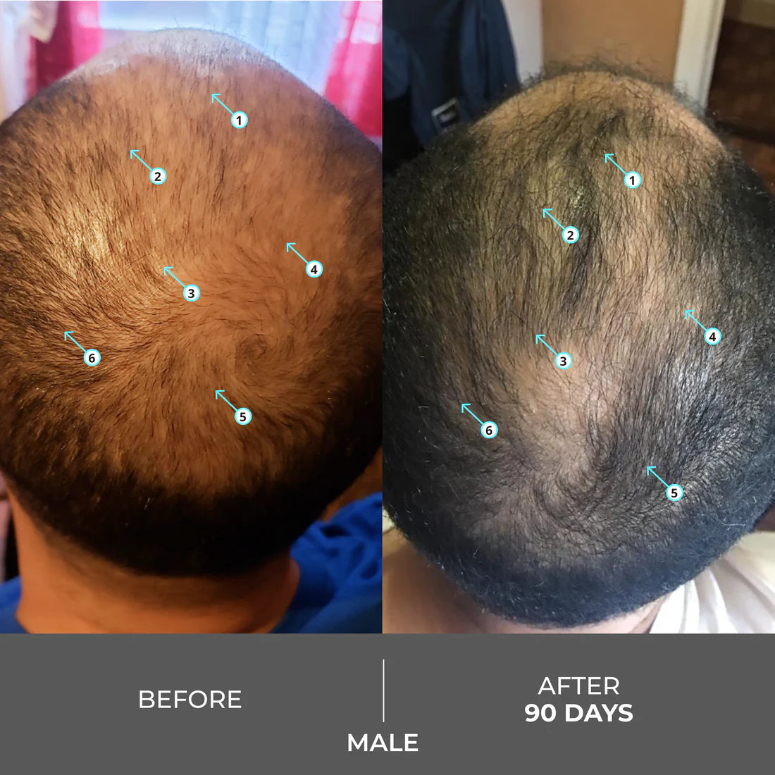 DS Laboratories Revita Shampoo gegen Haarausfall