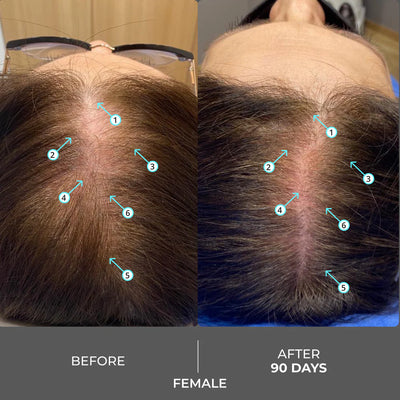 DS Laboratories Revita Shampoo gegen Haarausfall