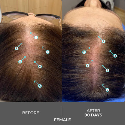 DS Laboratories Revita Shampoo gegen Haarausfall