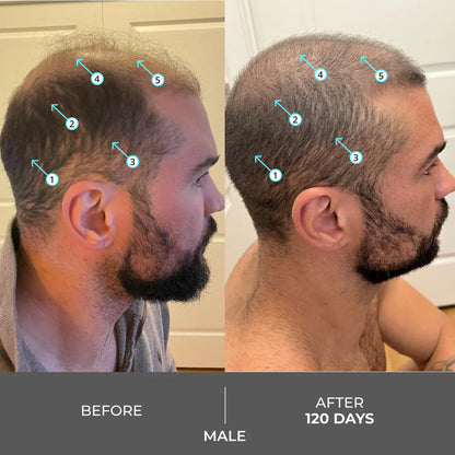 DS Laboratories Revita Shampoo gegen Haarausfall