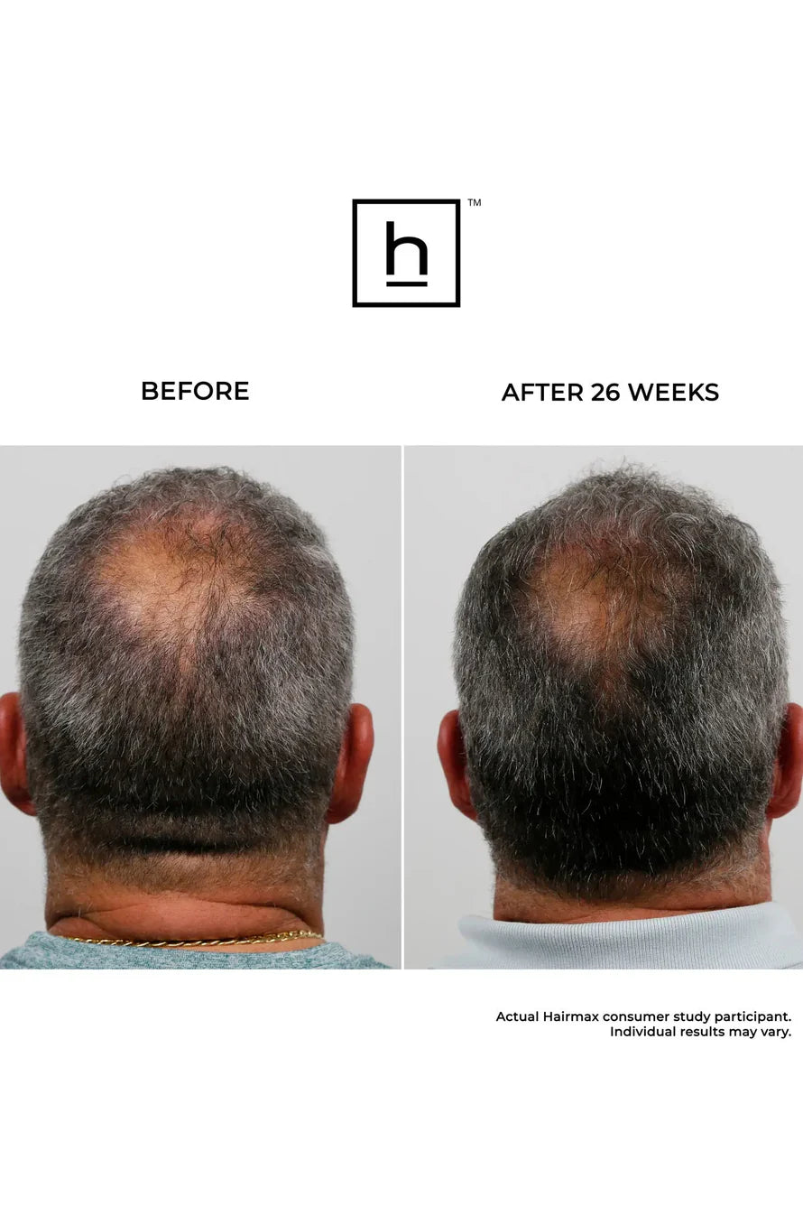 Hairmax Laserkamm Ultima 9. 2.0