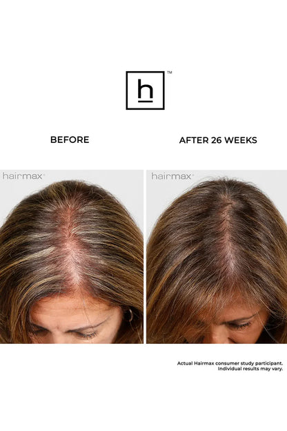 Hairmax Laserkamm Ultima 9. 2.0