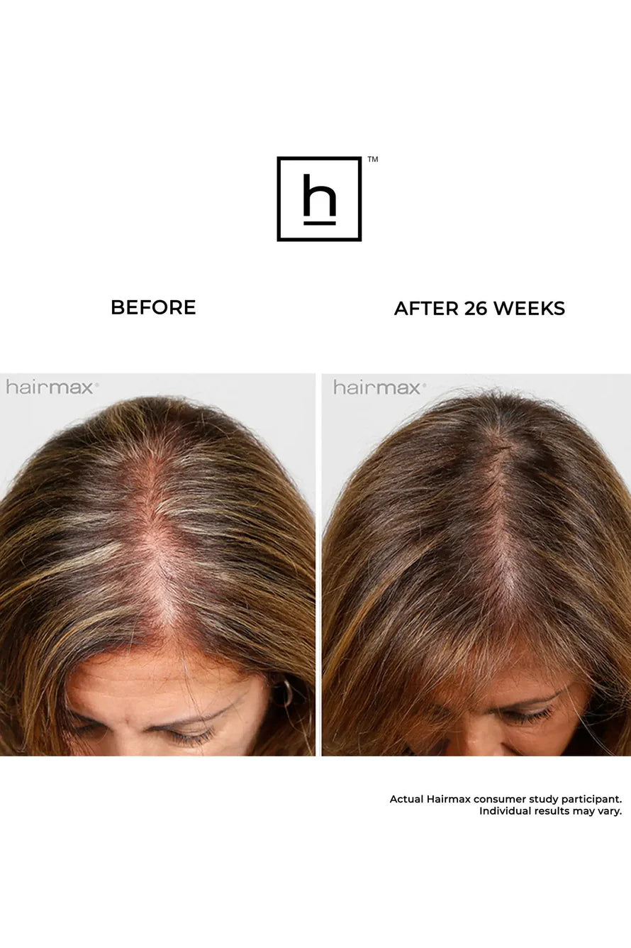 Hairmax Laserkamm Ultima 9. 2.0