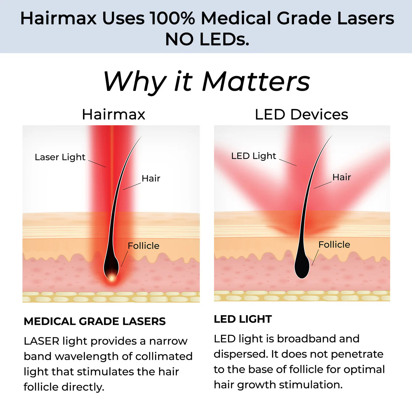 Hairmax Laserkamm Ultima 9. 2.0