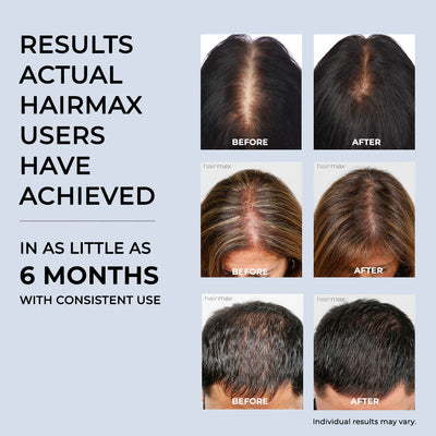 Hairmax Laserkamm Ultima 9. 2.0