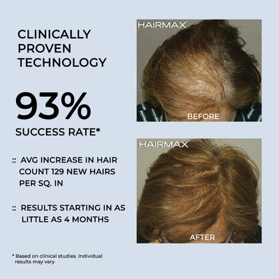 Hairmax Laserkamm Ultima 9. 2.0