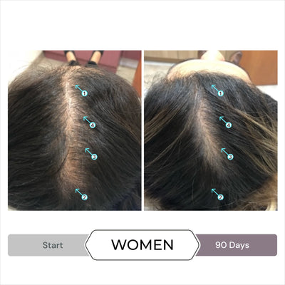 Haarausfall-Set für Frauen (Revita Shampoo/Conditioner + Spectral.CSF)