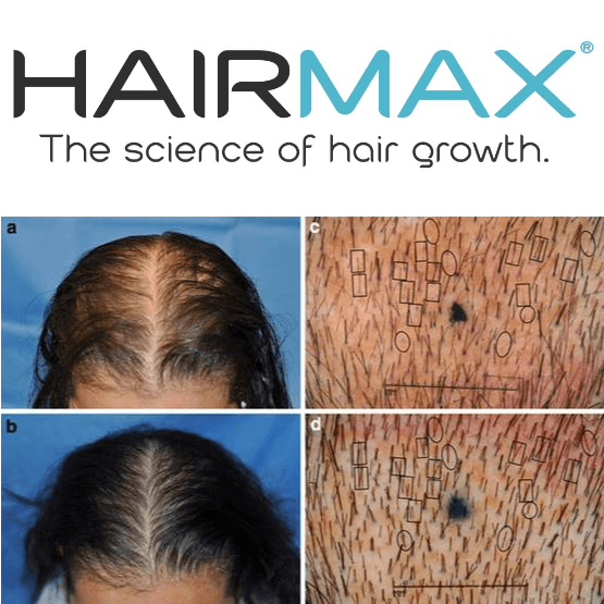 Hairmax Laserband 82 