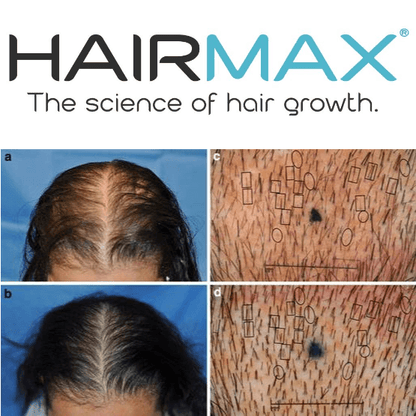 Hairmax LaserBand 41 Comfort Flex